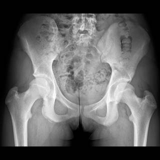 ACR Continuous Professional Improvement