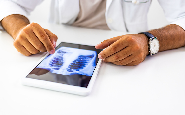 photo of hands holding ipad showing a chest scan