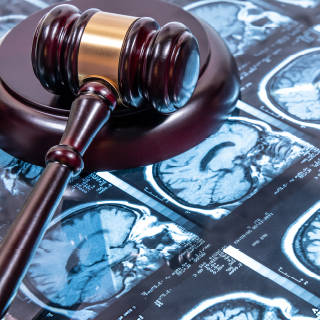 Judge's gavel sitting on top of MRI