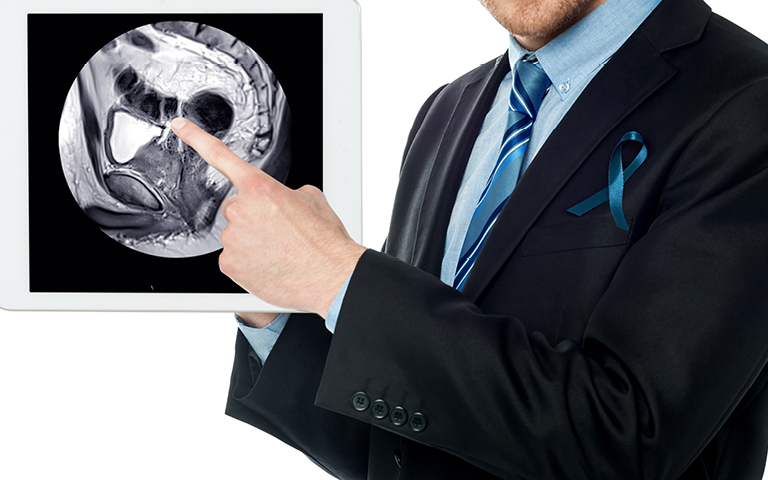 Photo of a man pointing to an MRi of a Prostate Gland