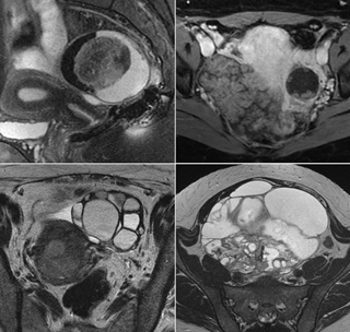MRI ORADS Images