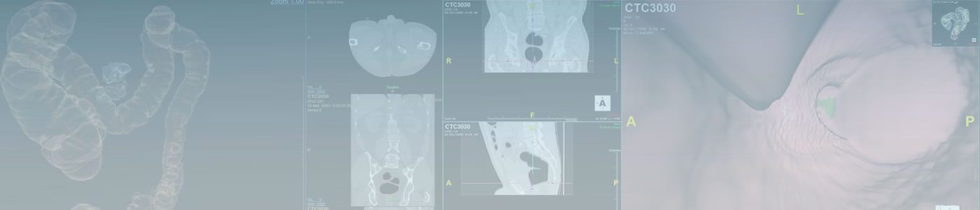 CTColon_1400