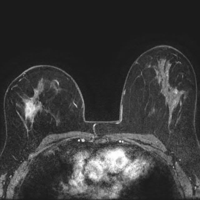 BreastandWomenImaging_640