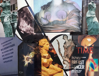 History of Breast Imaging: A Pictorial book